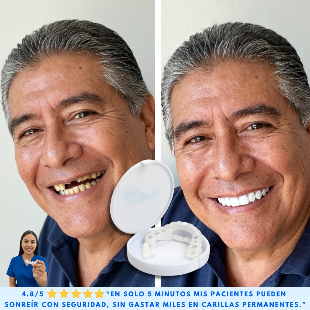 CARILLAS CERÁMICAS DENTALES KIT COMPLETO - SMILEFLEX™