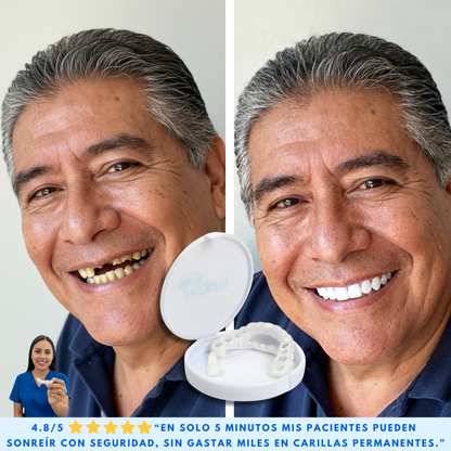 CARILLAS CERÁMICAS DENTALES KIT COMPLETO - SMILEFLEX™