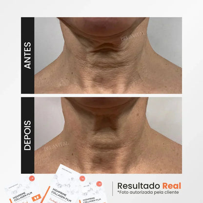 MÁSCARA DE COLÁGENO + ACIDO HIALURÓNICO + ACTIVO DE BOTOX - GOLDBOTOX